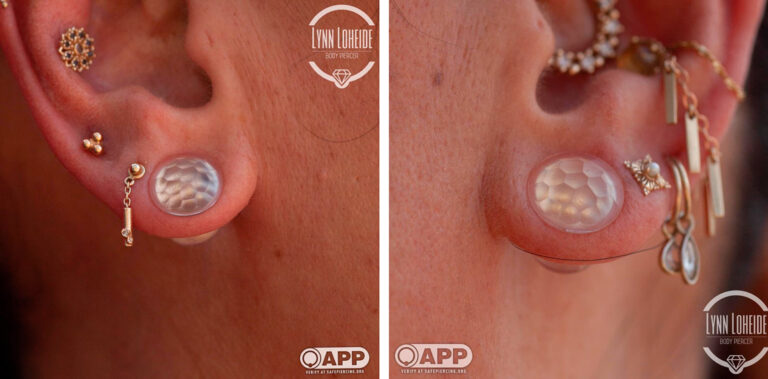 Lynn Loheide, USA lynnloheide earproject